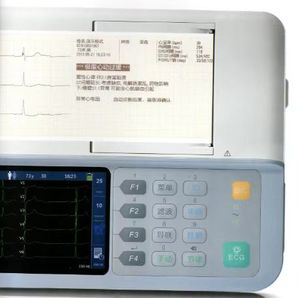 Mindray BeneHeart R3, électrocardiographe portable 3 canaux abordable, certifié CE classe I, batterie longue durée - Product Image 4