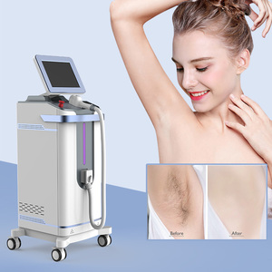 Keylaser K18 Depilación indolora 1600W 4 Wave <span class=keywords><strong>Ice</strong></span> <span class=keywords><strong>soprano</strong></span> Titanio 808 nm <span class=keywords><strong>Depiladora</strong></span> Láser de Diodo Dispositivo de belleza Láser Co2 - Product Image 3