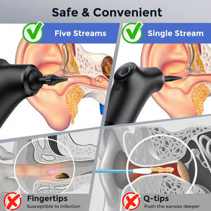 Système d'irrigation automatique des <span class=keywords><strong>oreilles</strong></span> rechargeable par USB, kit <span class=keywords><strong>de</strong></span> nettoyage électrique des <span class=keywords><strong>oreilles</strong></span>, éliminateur <span class=keywords><strong>de</strong></span> cérumen alimenté par <span class=keywords><strong>l</strong></span>'<span class=keywords><strong>eau</strong></span> - Product Image 6