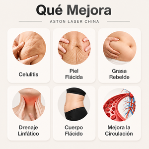 Máquina de Terapia con Rodillos Internos Aston, Quemador de Grasa Abdominal, Adelgazante de Brazos y Piernas, Eliminación de Celulitis, Equipo de Salón de Belleza - Product Image 6