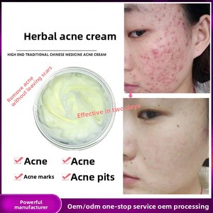 Crème Visage <span class=keywords><strong>Anti</strong></span>-Acné à l'Acide Salicylique à Effet Rapide, Très Vendue, avec Traitement Blanchissant et Cicatrisant, Soin de la Peau Marque Privée - Product Image 3
