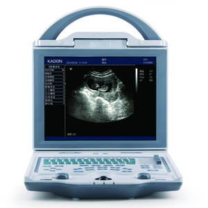 Pet Vet Diagnostic Medizinischer Veterinär Ultraschall Gallenblase Mucocele Hund Ultraschall gerät - Product Image 1