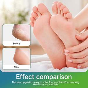 Lima de Pedicura Profesional de Lujo, Amarilla, de Nanovidrio, Removedor de Callos Dorado - Product Image 3