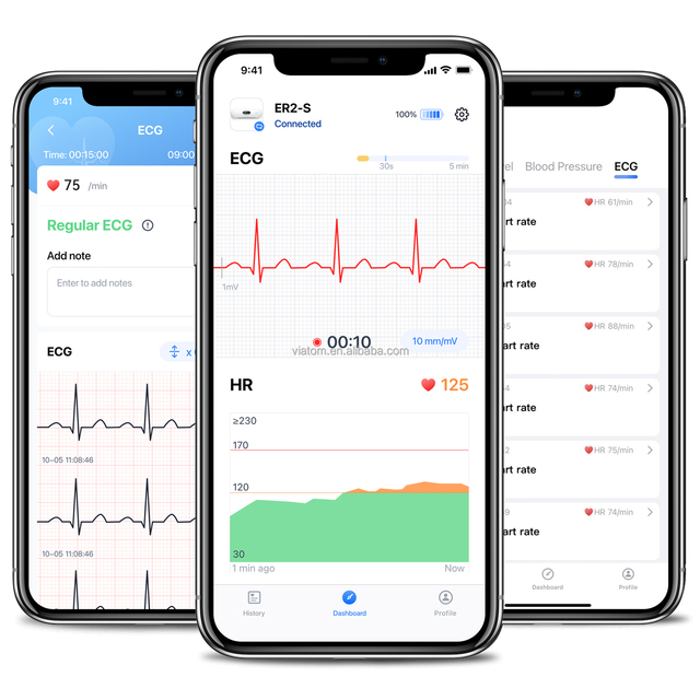 Viatom Duoek Mini Ecg Portable Monitor OLED Personal Ecg Monitor Portability Single-Lead Holter Recorder Handheld Ecg