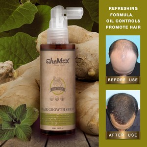 Natural best quality ginger hair products for perdida de cabello - Product Image 2