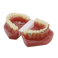 Modèle de dent buccale d'anatomie de dentiste pour l'étude orthodontique, amovible directement en usine