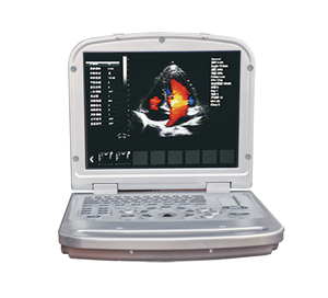 Sondas Convexas y Lineales, Escáner de Ultrasonido Doppler a Color para Laptop, Ultrasonido Veterinario, Máquina de Ultrasonido Portátil - Product Image 1