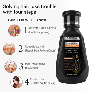 <span class=keywords><strong>Shampoo</strong></span> Anticaduta allo Zenzero e Biotina <span class=keywords><strong>per</strong></span> Uomini e Donne, Controllo della <span class=keywords><strong>Forfora</strong></span> e Cura del Cuoio Capelluto Grasso con Trattamento alla Cheratina <span class=keywords><strong>per</strong></span> <span class=keywords><strong>la</strong></span> Crescita dei Capelli 250ml - Product Image 1