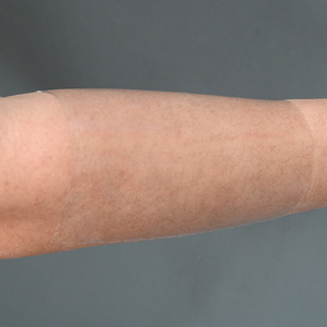 ضمادة لاصقة شفافة من البولي يوريثان مقاومة للماء ومانعة للنزيف، معتمدة من الاتحاد الأوروبي من الفئة الأولى، مع خاصية التعقيم بالأشعة تحت الحمراء البعيدة - Product Image 3