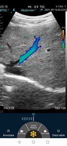 Escáner <span class=keywords><strong>de</strong></span> Ultrasonido <span class=keywords><strong>Doppler</strong></span> Color Inalámbrico Konted DYX10RL, Equipo Electrónico Óptico Portátil para Veterinaria - Product Image 4