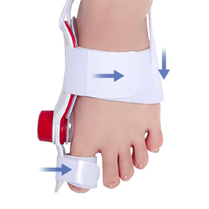 Tech Love Stepless Knob Bunion Corrector Brace pour un Hallux Valgus efficace et un <span class=keywords><strong>traitement</strong></span> des orteils chevauchants - Product Image 1