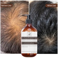 Pousse Cheveux Traitement professionnel de la chute des cheveux et de la croissance des cheveux Shampooing épaississant volumateur pour le traitement de la perte de cheveux