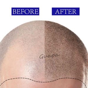 Offre Spéciale Corée SMP Scalp Micropigmentation Device Swiss Motor Tattoo <span class=keywords><strong>Machine</strong></span> avec cartouche Aiguille pour Camouflage Femelle Cheveux - Product Image 5