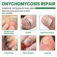 Sérum de Traitement Haute Qualité pour Mycoses des Ongles, Produits Réparateurs pour les Mycoses des Orteils, Gel de Soin Mains et Pieds, Anti-Onychomycose et Paronychie