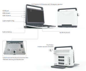 Ecógrafo Portátil de la Marca Zoncare M7, Proveedor Chino al por Mayor, Sistema de Ecografía Veterinaria Doppler a Color con Monitor LCD de 15.6 Pulgadas - Product Image 2
