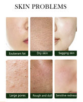 Coffret Visage Naturel Marque Blanche Éclatant, Blanchissant, Anti-Âge avec Sérum et Crème Or 24 carats – Produits de Soin Visage Beauté