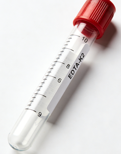 Macchina per Stampaggio a Iniezione Idraulica PET SV530/7300 Personalizzata con Controllo PLC per Produzione di Tubi per Prelievo Sangue ad Alto Volume - Product Image 2