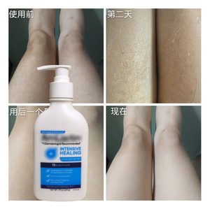 Lozione Corpo Extra Schiarente Biologica Idratante per <span class=keywords><strong>Pelle</strong></span> da <span class=keywords><strong>Secca</strong></span> a <span class=keywords><strong>Molto</strong></span> <span class=keywords><strong>Secca</strong></span> - Product Image 3