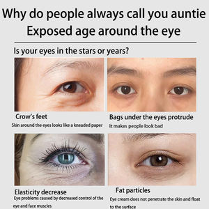 Homeuse Masseur facial électrique Équipement de beauté à main pour le lifting de la peau et le traitement du visage anti-rides - Product Image 3