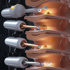 Endoscope auriculaire H30S AI pour l'évaluation auditive et l'assistance à distance, contrôlé par application, portable, compatible Wi-Fi, pour l'élimination du cérumen - Product Image 4