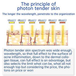 Macchina di Bellezza da Tavolo S.W per Rimozione Pigmenti, Rassodamento della Pelle, Depilazione con 2 Manipoli, Attrezzatura Estetica per Uso Domestico - Product Image 5