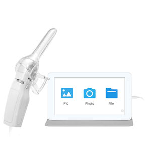 Colposcopio Portátil Mini, Equipo Médico Eléctrico de Diagnóstico Cervical con Video para Ginecología, Herramienta de Examen Femenino - Product Image 4