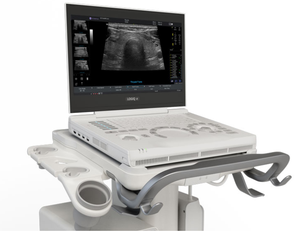 Ecógrafo Portátil GE LOGIQ E de <span class=keywords><strong>Segunda</strong></span> <span class=keywords><strong>Mano</strong></span>, Reacondicionado, con Sonda Convexa y Doppler Color para Hospital - Product Image 1