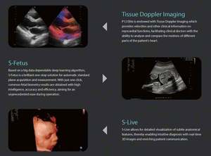 Appareil d'échographie Doppler couleur Sonoscape P12Elite 4D avec fonction IA et grand écran pour l'obstétrique/la cardiologie/l'abdomen - Product Image 5