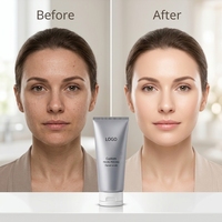 Gel exfoliant doux personnalisable adapté aux peaux grasses, utilisation corporelle