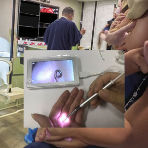 3.9mm HD 1080P tıbbi ev sağlık burun boğaz kulak otoskop 4.5 görsel dijital ENT LCD endoskop - Product Image 1