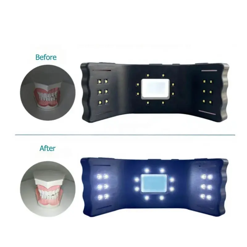 歯科写真口腔充填ランプフラッシュライト歯科医ラボ機器