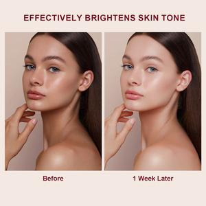 Belleza Piel Hidratante Nicotinamida Coreana Brillo Cambio de color <span class=keywords><strong>Crema</strong></span> blanqueadora facial - Product Image 6