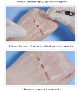 Fermeture rapide et facile pour plaies multiples <span class=keywords><strong>Zipstitch</strong></span> Stitchless Solution Kit de fermeture de plaie - Product Image 4