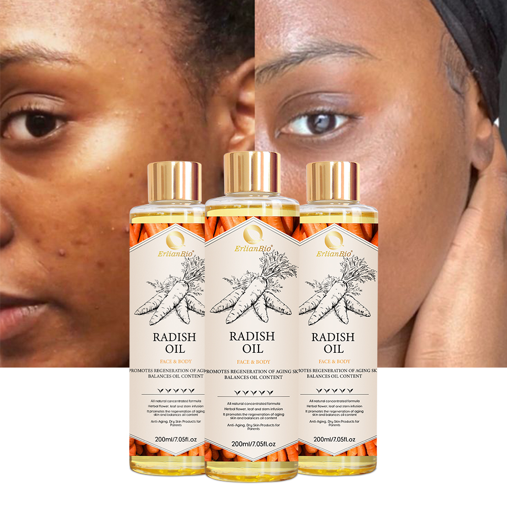 Wholesale Carrot Whitening Body Care Essence Oil Light Dark Spot Remove Scar Natural Carotene Essential Oil Private Label