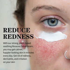 <span class=keywords><strong>Crème</strong></span> hydratante pour le <span class=keywords><strong>visage</strong></span> <span class=keywords><strong>anti</strong></span>-rougeur pour peau sensible à tendance acnéique de marque privée - Product Image 2