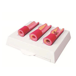 Anatomía humana 4 etapas Arteria y vasos sanguíneos <span class=keywords><strong>Medicina</strong></span> Patología trombo modelo - Product Image 4