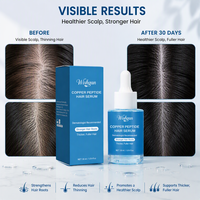 Minyak Rambut OEM Blue Copper Peptide - Memperkuat Akar, Menutrisi, Meningkatkan Volume, Cocok untuk Semua Jenis Rambut