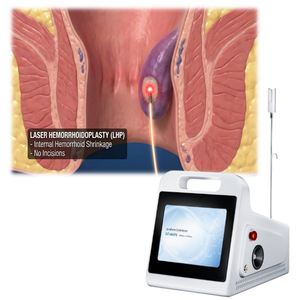 Germany <span class=keywords><strong>Laser</strong></span> EVLT multifuncion lipolysis quirurgica 980 liposuction <span class=keywords><strong>laser</strong></span> maquina <span class=keywords><strong>laser</strong></span> vascular diodo <span class=keywords><strong>laser</strong></span> 1470nm Endolaser - Product Image 5
