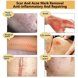 Creme removedor de acne, remoção de espinhas e cicatrizes para rosto e pernas, creme removedor de cicatrizes