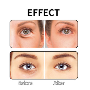 Vente en gros Améliorez le contour des yeux Formule végétale naturelle Doux Non irritant Parfait pour les hiboux de nuit crème pour les yeux - Product Image 3