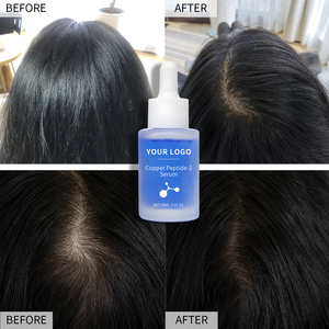 The Ordinary Hair Peptide Before and After