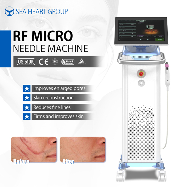 2026 Newest Vacuum RF Microneedling Machine 2.2MHz Fractional Radio Frequency for Skin Tightening & Deep Scar Removal Salon