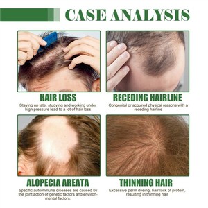 Gel para el Cuidado del Cabello Nouelv Batana, Puro, Natural, Orgánico, Suave, de Larga Duración, Promueve el Crecimiento del Cabello, Previene la Caída del Cabello - Product Image 4