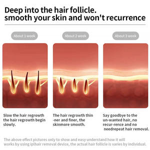 Moolweel T023K OEM 510K IPL Machine Usage Domestique Portable ÉPILATEUR IPL Permanent Ligne de Bikini Indolore Épilation au <span class=keywords><strong>laser</strong></span> pour aisselles - Product Image 4