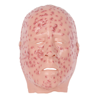 Máscara de silicona de maniquí para entrenamiento médico: modelo de exhibición facial de viruela severa