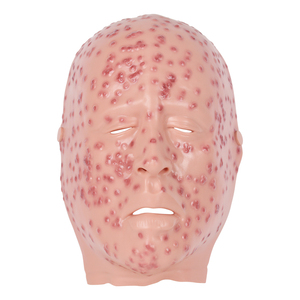 Máscara de silicona de maniquí para entrenamiento médico: modelo de exhibición facial de viruela severa - Product Image 1