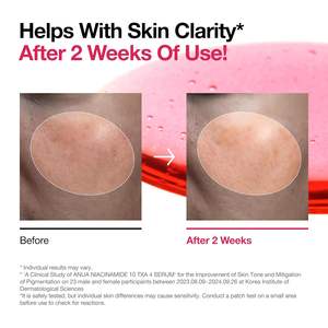 Sérum Anua Niacinamide 10 Tx A 4 30 ml, soin anti-taches pour le visage - Product Image 4