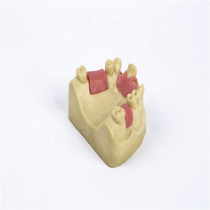 การสอนเข่า implant Model - Product Image 6