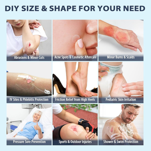 ハイドロコロイドロールにきびパッチボディワウンドケア用-個人パック3年の寿命 - Product Image 5