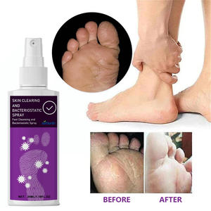Gran oferta, textura cómoda y refrescante, piel fresca de absorción rápida para mantener la piel del pie, espray para el cuidado de los pies - Product Image 4